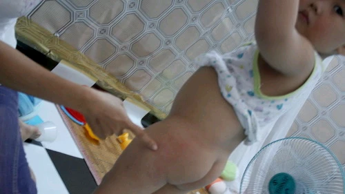 Bé 2 tuổi bị đánh: Phụ huynh bảo có, nhà trường nói không ảnh 1 Bé 2 tuổi bị đánh: Phụ huynh bảo có, nhà trường nói không ảnh 1