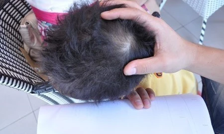 Vụ bé 3 tuổi bị 'chấn động não': Công an vào cuộc ảnh 1 Vụ bé 3 tuổi bị 'chấn động não': Công an vào cuộc ảnh 1