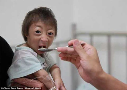 Lạ lùng bé gái không bao giờ lớn ảnh 4 Lạ lùng bé gái không bao giờ lớn ảnh 4