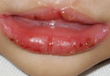 Kawasaki: Kẻ đội lốt nguy hiểm ảnh 2 Kawasaki: Kẻ đội lốt nguy hiểm ảnh 2