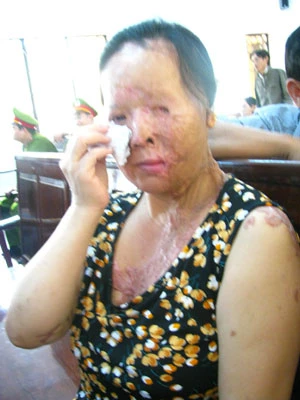Thuê người tạt acid bạn làm ăn ảnh 2