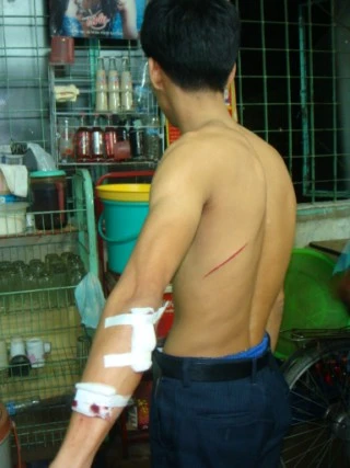 "Xã hội đen" mang côn nhị khúc náo loạn bệnh viện ảnh 1 "Xã hội đen" mang côn nhị khúc náo loạn bệnh viện ảnh 1