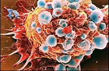 Phát hiện ra loại protein có thể ngừa ung thư vú ảnh 1 Phát hiện ra loại protein có thể ngừa ung thư vú ảnh 1