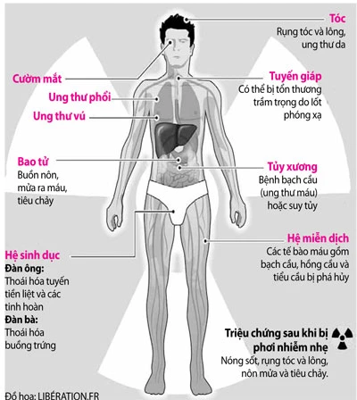 Phóng xạ hạt nhân có thể gây bệnh gì? ảnh 2