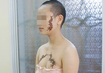 Cô gái bị ép xăm hình quái vật: UBND tỉnh Nghệ An đề nghị công an tỉnh phối hợp điều tra ảnh 1 Cô gái bị ép xăm hình quái vật: UBND tỉnh Nghệ An đề nghị công an tỉnh phối hợp điều tra ảnh 1