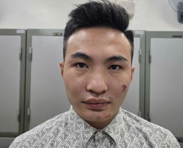 Nam thanh niên điều khiển xe máy đâm vào cán bộ Công an làm nhiệm vụ bảo vệ A80