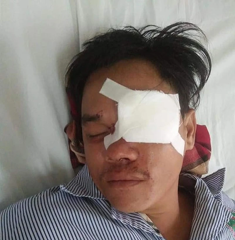 Manh mối tìm ra nhóm đâm chết người nhà con nợ ở quận 3 ảnh 3 'Tín dụng đen' đâm mù mắt người vay nợ không có tiền trả - ảnh 1