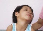 Xử nghiêm vụ bé gái 4 tuổi bị cha dượng bạo hành 