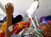Làm rõ vụ cán bộ rừng bị chém đứt gân tay