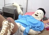Nổ bình ga trong đám tang, 5 người nhập viện 