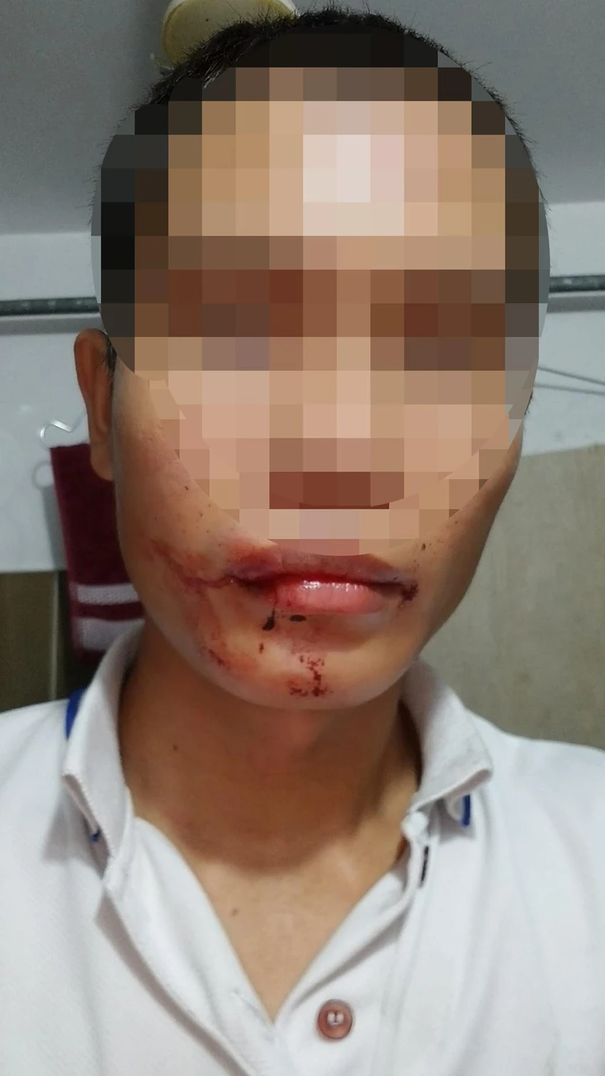 Vụ việc khiến anh H bị thương ở vùng mặt. Ảnh: NDCC Vụ việc khiến anh H bị thương ở vùng mặt. Ảnh: NDCC