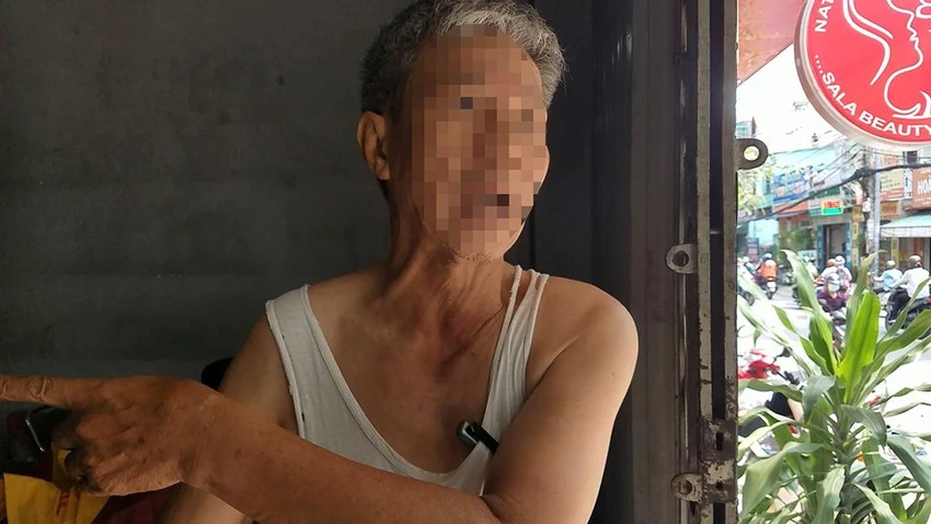 Theo ông H, nhóm này chém nhiều nhát trúng xe máy, ném gạch đá, hung khí vào nhà. Ảnh: HT