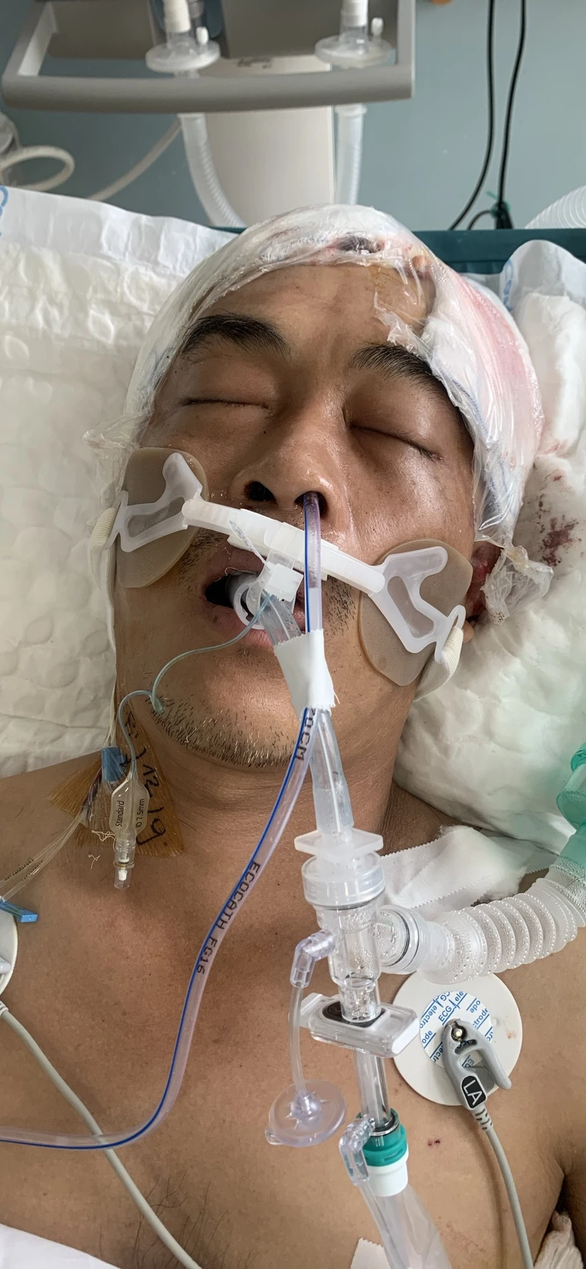 Công an hiện đang tìm thân nhân của người đàn ông bị thương trong vụ tai nạn giao thông ở quận 12. Ảnh: CA Công an hiện đang tìm thân nhân của người đàn ông bị thương trong vụ tai nạn giao thông ở quận 12. Ảnh: CA