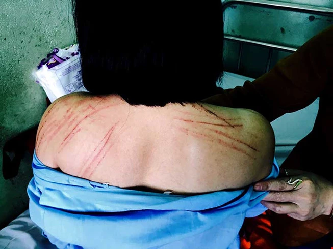 Đề nghị điều tra vụ nữ luật sư bị đánh gãy 2 cái răng ảnh 1