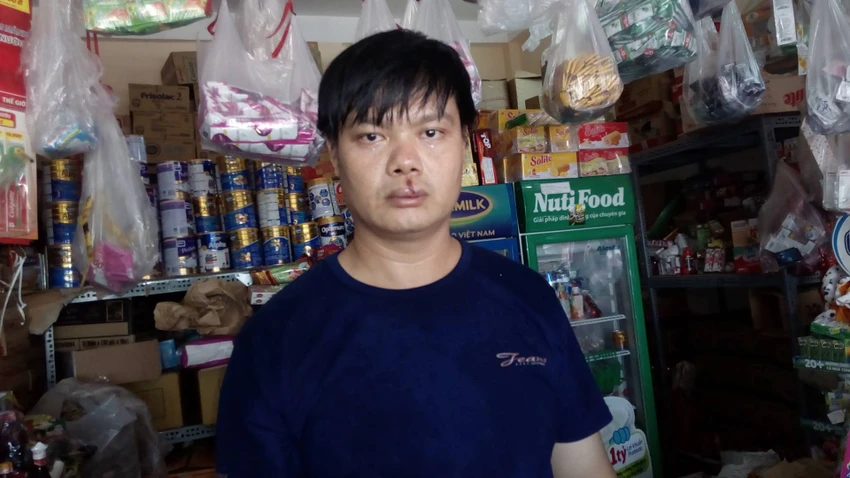 Nghi án bị đánh trọng thương vì tố cáo công ty gây ô nhiễm ảnh 1 Nghi án bị đánh trọng thương vì tố cáo công ty gây ô nhiễm ảnh 1