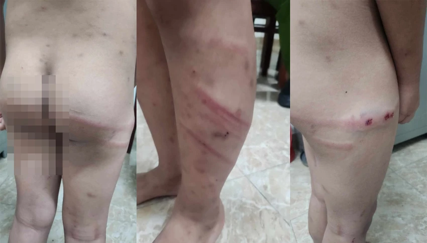 Lời khai người mẹ vụ cùng bạn trai bạo hành con trai 11 tuổi.jpg