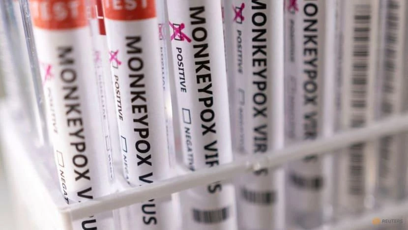 Các ống nghiệm có dán nhãn "dương tính với virus đậu mùa khỉ". Ảnh: REUTERS Các ống nghiệm có dán nhãn "dương tính với virus đậu mùa khỉ". Ảnh: REUTERS