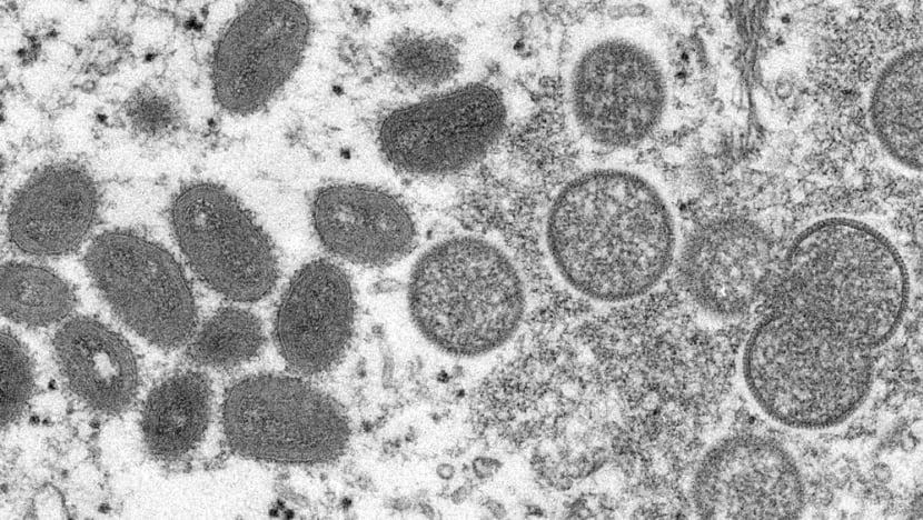 Hình ảnh kính hiển cho thấy virus đậu mùa khỉ trưởng thành (trái) và virus chưa trưởng thành (phải) thu được từ mẫu da người. Ảnh: AP Hình ảnh kính hiển cho thấy virus đậu mùa khỉ trưởng thành (trái) và virus chưa trưởng thành (phải) thu được từ mẫu da người. Ảnh: AP
