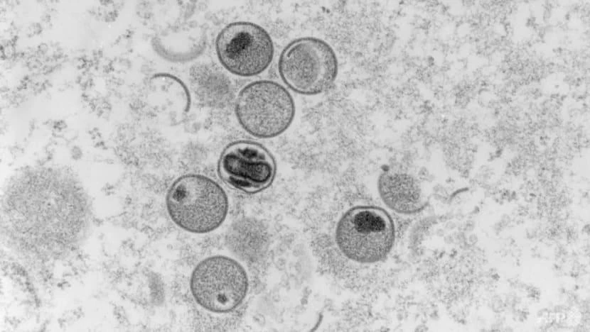 Ảnh chụp từ kính hiển vi điện tử cho thấy tiết diện siêu mỏng của virus đậu mùa khỉ. Ảnh: AFP Ảnh chụp từ kính hiển vi điện tử cho thấy tiết diện siêu mỏng của virus đậu mùa khỉ. Ảnh: AFP