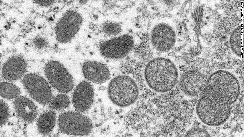 Hình chụp kính hiển vi cho thấy hình dáng của virus bệnh đậu mùa khỉ. Ảnh: CNN Hình chụp kính hiển vi cho thấy hình dáng của virus bệnh đậu mùa khỉ. Ảnh: CNN