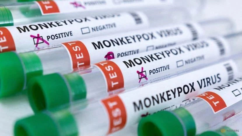 Các ống nghiệm có dán nhãn "âm tính và dương tính với virus đậu mùa khỉ". Ảnh: REUTERS Các ống nghiệm có dán nhãn "âm tính và dương tính với virus đậu mùa khỉ". Ảnh: REUTERS