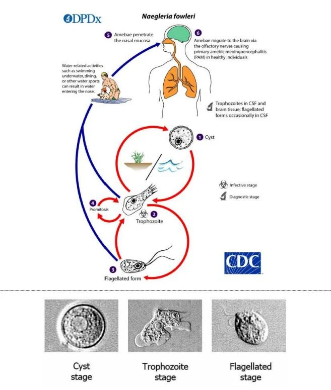 Con đường lây nhiễm của amip ăn não Naegleria folweri. Ảnh: KDCA Con đường lây nhiễm của amip ăn não Naegleria folweri. Ảnh: KDCA