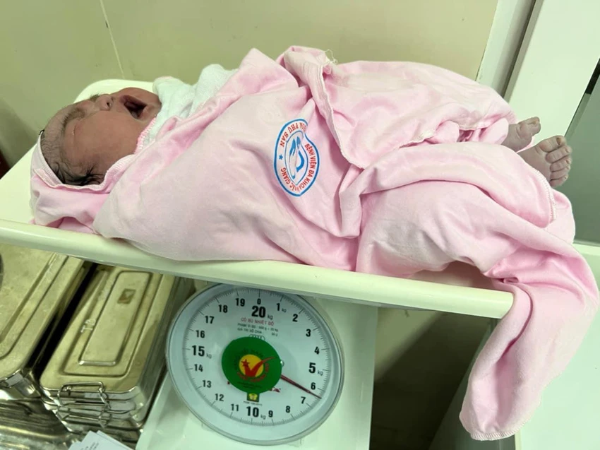 Bé gái đã chào đời an toàn với cân nặng 6,2 kg trước sự bất ngờ của mẹ và toàn bộ kíp phẫu thuật. Ảnh: BV Bé gái đã chào đời an toàn với cân nặng 6,2 kg trước sự bất ngờ của mẹ và toàn bộ kíp phẫu thuật. Ảnh: BV