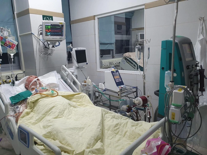 Bệnh nhân được can thiệp ECMO và lọc máu liên tục. Ảnh: BVCC Bệnh nhân được can thiệp ECMO và lọc máu liên tục. Ảnh: BVCC