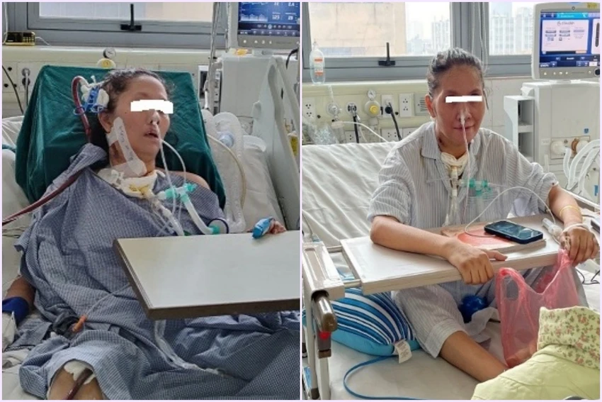 Bệnh nhân ngừng ECMO và thở máy sau 50 ngày. Bệnh nhân ngừng ECMO và thở máy sau 50 ngày.