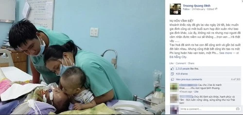 Bức ảnhbé Phi Longhôn bé Phi Phụngvới tựa đề 'Nụ hôn vĩnh biệt' được Bác sĩ Trương Quang Định - người trực tiếp thực hiện ca phẫu thuật tách rời 2 bé sơ sinh dính liền tim gan đăng trên Facebook ngày 24/2.Vì rối loạn nhịp tim và suy hô hấp, bé Phi Phụng không thích nghi được với cuộc sống độc lập nên đã tử vong hôm 23/2.Bức ảnh cảm động này đã nhận được nhiều lượt chia sẻ của cư dân mạng. Bức ảnh chụp hai bé hôn nhau trên giường bệnh với tựa đề 'Nụ hôn vĩnh biệt' được Bác sĩ Trương Quang Định- người trực tiếp thực hiện ca phẫu thuật tách rời 2 bé sơ sinh dính liền tim gan đăng tải trên Facebook cá nhân của mình ngày 24/2.