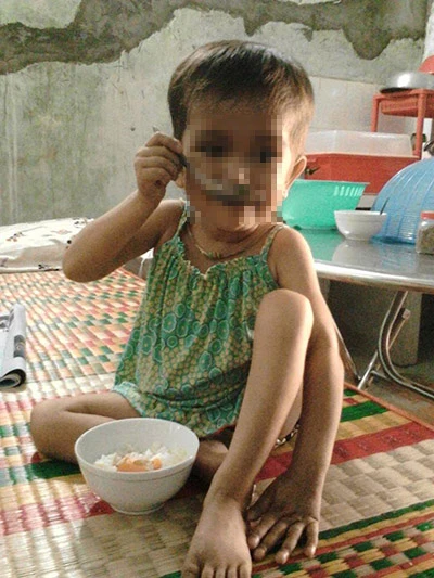 Em bé nhiễm HIV và lòng tốt của những người dưng ảnh 7 Em bé nhiễm HIV và lòng tốt của những người dưng ảnh 7