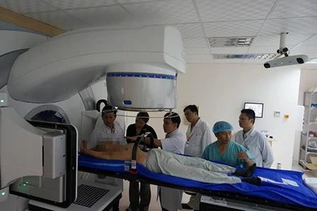 Lần đầu tiên xạ phẫu đối với bệnh nhân có khối u ở gan ảnh 1