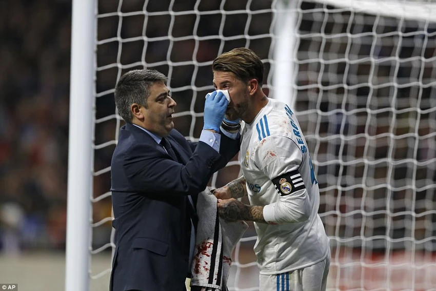 Derby thành Madrid nhạt nhòa, bạo lực và penalty... hụt ảnh 4