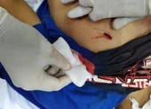Bí ẩn người phụ nữ đưa nạn nhân bị đâm thấu ngực vào viện 