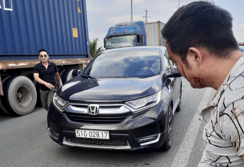 Anh Tú bị đánh gây thương tích. Ảnh: NVCC Anh Tú bị đánh gây thương tích. Ảnh: NVCC