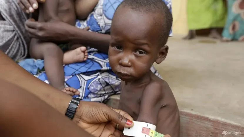 Bác sĩ chăm sóc một trẻ em suy dinh dưỡng tại trại tị nạn ở thành phố Yola, Nigeria vào ngày 3-5-2015. Ảnh: AP Bác sĩ chăm sóc một trẻ em suy dinh dưỡng tại trại tị nạn ở thành phố Yola, Nigeria vào ngày 3-5-2015. Ảnh: AP