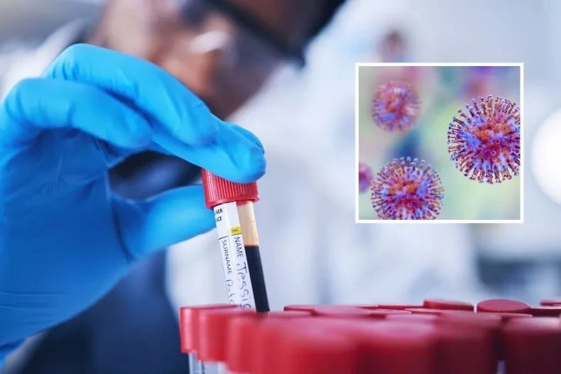 300 mẫu virus nguy hiểm biến mất khỏi phòng thí nghiệm Úc