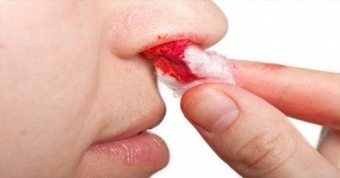 Hậu quả đáng sợ nhất của oral sex ảnh 2 Hậu quả đáng sợ nhất của oral sex ảnh 2